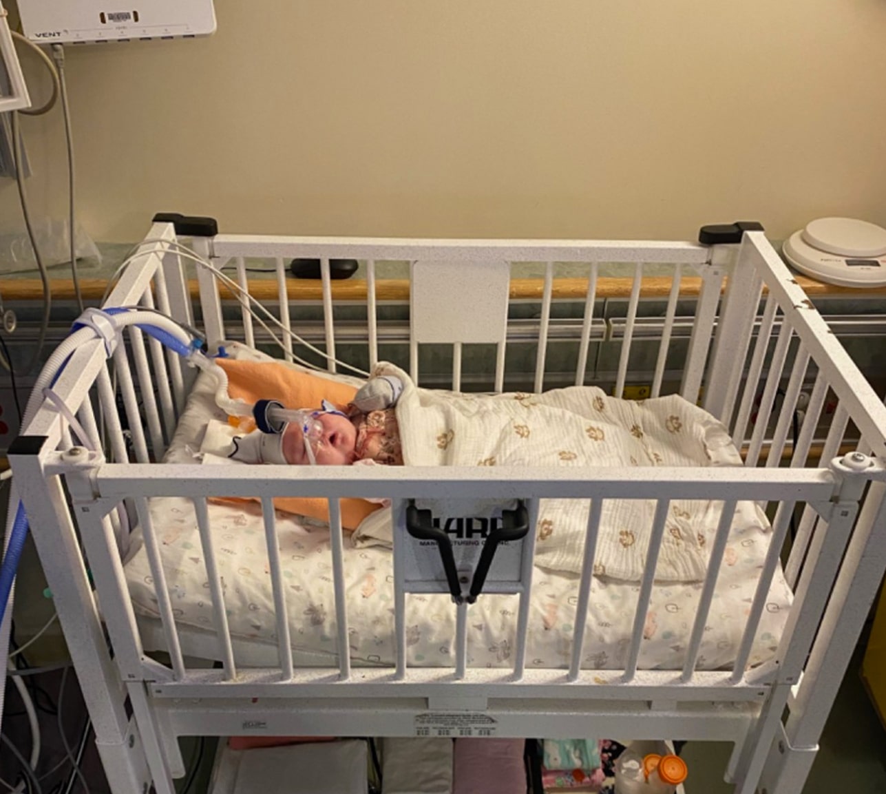 Infant lying in a hospital crib with breathing support, covered in a blanket, receiving medical care.